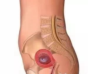 第一个月是受精卵发育的过程