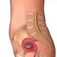 第一个月是受精卵发育的过程 第二个月的胎儿 第三个月 第四 第五 六 七 八 九 第十个月的胎儿