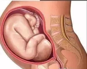 第十个月的胎儿