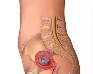 第二个月的胎儿