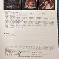 今天刚做的三维，能看出男女吗？这的医院双胎不给做四维，所以没有面部成像，哎，真的很好奇男女，检查...