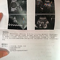 有宝妈会算胎儿的体重的吗，麻烦给算下吧，谢谢了🙏