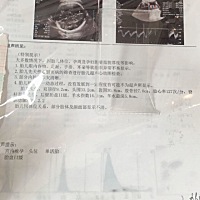 36+3了，看着脑袋大吖，胎心监护有点平，下午再做一次去，最近宫缩有点频繁了，一小时超过10次了就要去...