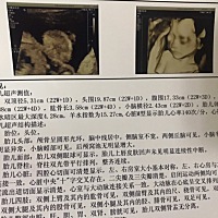 今天四维宝宝超配合的，30分钟不到所有部位看完，医生也特别好，有什么想问的也不会不理睬，所有检查一...