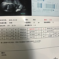 快七斤了，还没完全入盆。也不晓得男女。越来越害怕。。。。