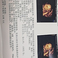 宝妈们帮忙看看男女