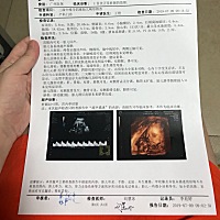 经过5次终于成功把四维照完了，安全，据说有大神能过通过数据看男女，能给分析分析是个公主不
