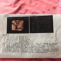 四维拍了一天半8次就是不翻身看一下脊柱最后还是没有拍到。医生都说很少见到这么固执的孩子。看一下是男...