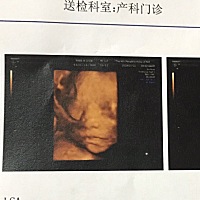 约的四维，今天去检查成了三维，宝宝很给力十几分钟就完成，NT 唐筛 糖耐 通通一次过，非常感谢你心疼麻...