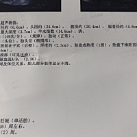 记录：26周复查➕糖耐。糖有点高，一天只能吃一种水果。这几周饿的快，吃的多，体重胖了12斤，吃凉的偶...