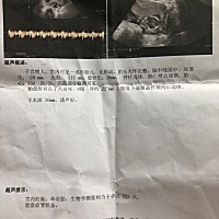 看的出是乔治还是佩奇吗？