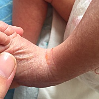 宝宝这个脚脖子裂了三四天了，涂了润肤霜还是不见好。