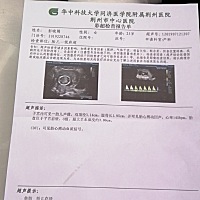 拍个B超啥都看不到，淡淡的忧伤