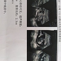 宝妈们帮我看看，男孩女孩