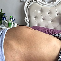 24周 体重没怎么变化 感觉肚子像畸形一样 躺下来特别怪！