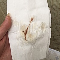 已经确认怀孕，时间比较短，今天上厕所用纸巾有这个，是什么原因，谢谢大家。