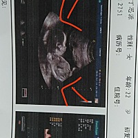 四维一次性通过啦   检查一切都好   还真是个天使宝宝   从怀上你这五个多月没有生过病   没有一点难受 ...