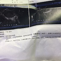 姐妹们谁看的懂这个卵泡成熟了吗 问了医生说能正常排卵 就是内膜有点薄 吃什么能增加内膜厚度 在备...