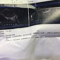 备孕中 这个卵泡算成熟吗 医生说子宫壁有点薄 这个会随着姨妈来潮增厚吗？请问吃什么可以增内膜 大家帮...