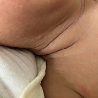 这几个小豆豆是什么？  有没有长过的宝宝