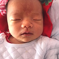 今天宝宝的压痕颜色淡了好多，有点黄疸吃的茵栀黄配妈咪爱，祈祷宝宝快点好起来🙏
