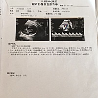 宝宝已经出生6天了，之前查出右侧脑室0.9左侧脑室扩张1.0，医生说没事，现在宝宝出生六天去复查右侧脑室...