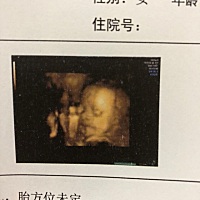 不要害怕担心分娩的痛，因为你担心也是痛，不担心也是痛，改变不了结局，还不如开开心心地去痛。原...