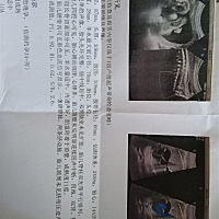 孕妈们看一下这正常吗？能看出是男宝还是女宝吗？