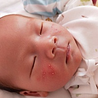 谁能帮忙看看宝宝脸上这个碍事吗？需要去医院吗？