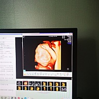 各位宝妈们看看这是小王子还是小公举的面相