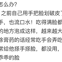 脸破皮了怎么办