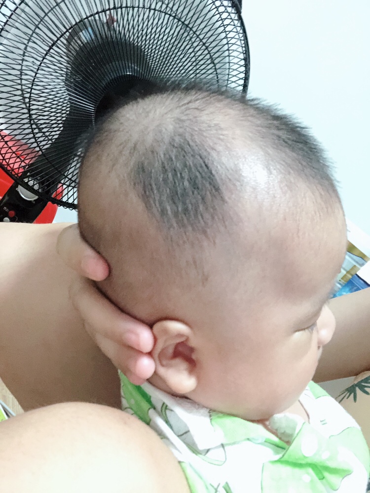 宝宝刚出生时头发黑黑的，满月剪头发就不长了。现在三个月半了。有宝妈知道这是什么原因吗