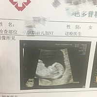 早期的B超图和思维数据。有经验的孕妈帮看看是男宝还是女宝