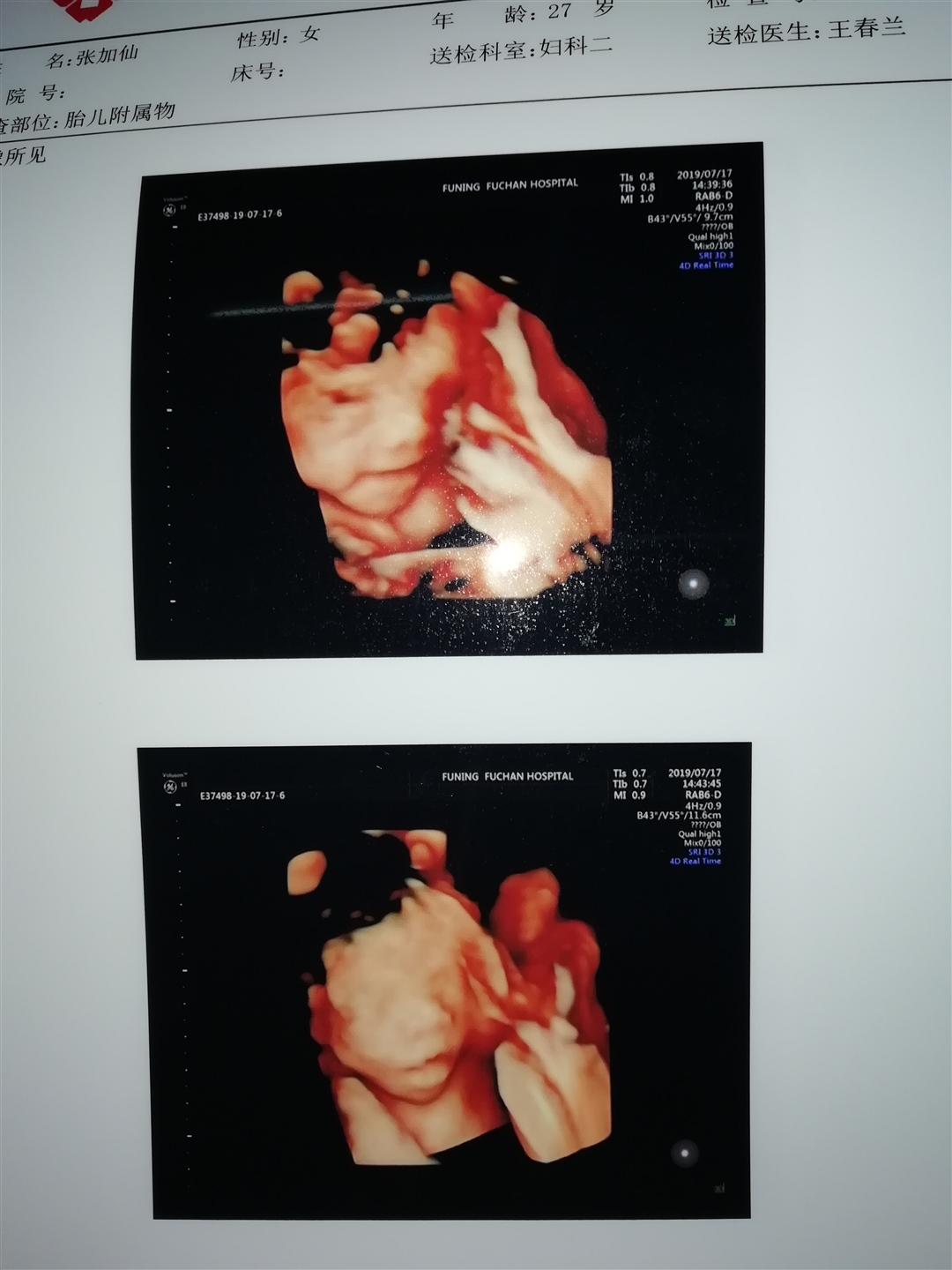 宝妈们帮忙看看是男孩还是女孩啊？