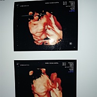 宝妈们帮忙看看男孩还是女孩啊？ 宝妈们帮忙看看是男孩还是女孩啊？