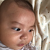 有谁知道宝宝长这个是什么东西，热了就红和痒，不热就不痒也不红，远看没什么看不出来长了，近看就很明...