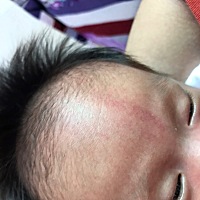 红色的是胎记吗，出生到现在20多天了还没