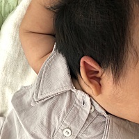 宝宝两个多月、耳朵从出生就这样、儿科医生说大一点自己会长好、可是没说多大能长好、有没有一样的宝妈...