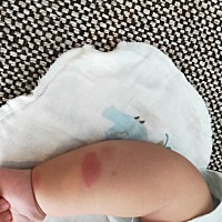 各位帮忙看看，这是长的什么吗?又好像是蚊子咬的都几天了也没消。