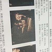 早上做的四维．能看出男女吗？