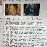 好动，不知道是男宝还是女宝