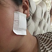你们有没有孕晚期得腮腺炎的 呢 怎么弄 在线等