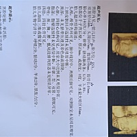 6个月，看指标像男还是女？