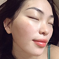 你们长妊娠斑了吗？一个孕期长了一脸