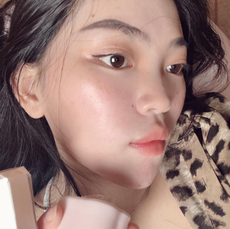 你们长妊娠斑了吗？一个孕期长了一脸