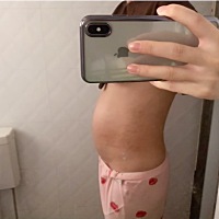 孕妈妈们一定要控制体重哦，不然后面好难恢复，我生了宝宝七天离孕前体重只差三斤了，肚皮虽然还有...