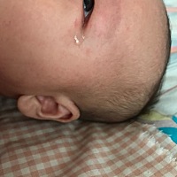 宝宝一直眼睛总流眼泪是怎么回事？有有类似经验的宝妈吗？