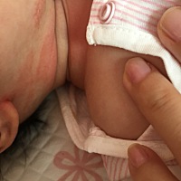 宝妈们，这是湿疹吗？有什么好的药膏推荐下，看着宝宝这样难受呀！