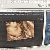 还有十几天就卸货了，越来越累，好希望提前发作，太想见到我宝贝了，不知是男是女，好期待！