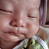 我宝宝现在已经27天了，新手妈妈，可是脸上长不知道是什么 担心，也不知道怎么才弄的好，求亲们解答一下...